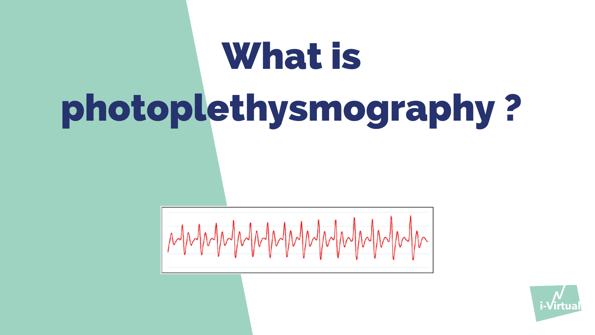 Monitoring Heart Rate with LED? Photoplethysmography (PPG)